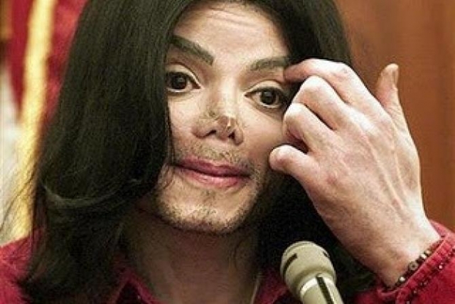 Поклонников Майкла Джексона могло мало что удивить во внешнем виде звезды, но фото с поврежденным носом произвело фурор даже среди них.