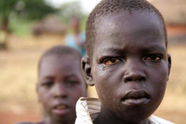 11. Кивательный синдром  Его открыли в Восточной Африке в 2010 году. В основном им страдают дети: пациенты постоянно кивают головой, что зачастую приводит к недоеданию и задержке роста. Врачи предполагают, что болезнь может быть вызвана паразитами, но они не уверены. 