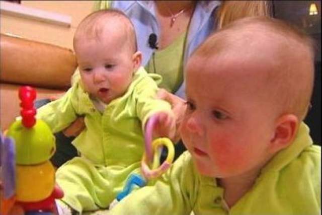 Сначала Гимбелы решили расстаться со слабым близнецом, но появилась альтернатива. С помощью лазеров врачи пережгли кровеносные сосуды, соединяющие близнецов, разделив их. Обе девочки-близнеца выжили и благополучно появились на свет. 