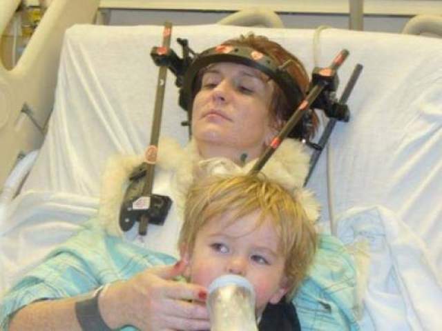 Женщина выжила после обезглавливая  В январе 2007 года Шэннон Мэллой попала в автокатастрофу, в результате чего ее череп был отделен от позвоночника. 